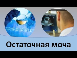Остаточная моча