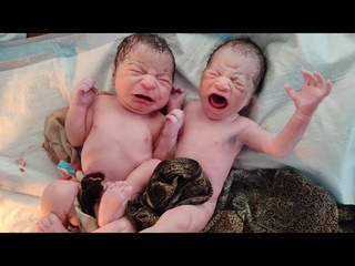 The Prince Charming Twins Newborn babies immediately after birth is the Cutest thing today