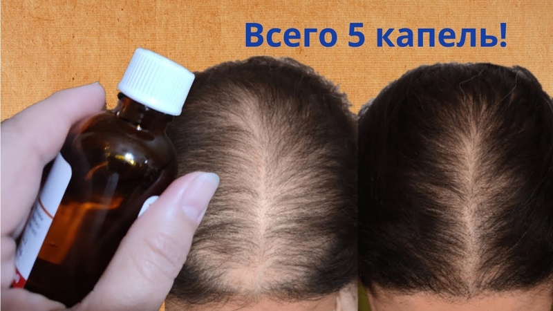 Всего 5 капель этого аптечного средства вместо дорогой
