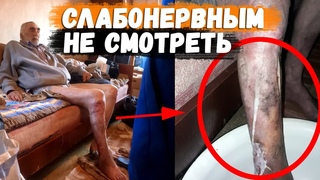 У нас стрессовое состояние от увиденного! С НОГИ ЧТО ТО ВЫТЕКАЕТ...
