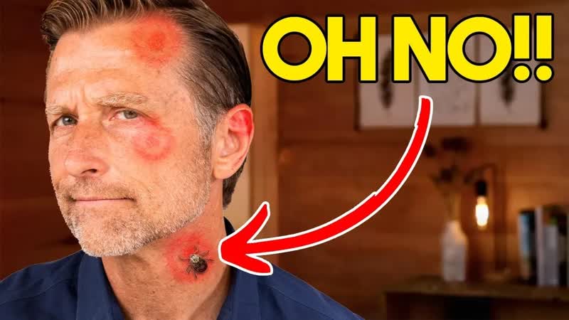 I Get 20 Tick Bites Every Week ( Lyme