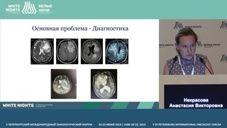 Опыт лечения лимфопролиферативных заболеваний у ВИЧ-инфицированных больных в СПб (Некрасова А.В.)