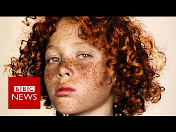Celebrating freckles in all their glory BBC