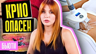 ЖУТКИЕ ПОСЛЕДСТВИЯ КРИОЛИПОЛИЗА | Должны знать все!