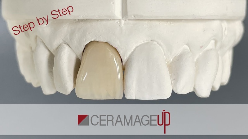 Ceramage UP Step by Step Version
