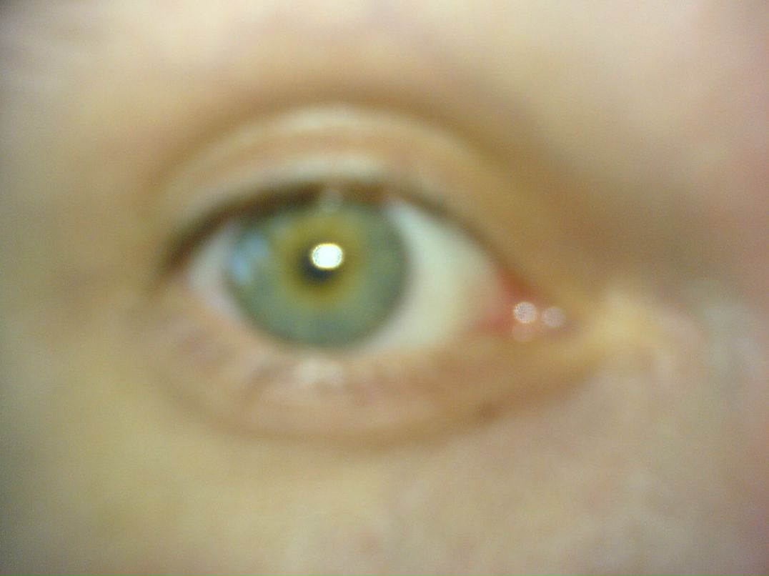 Антон Безфамилии | 