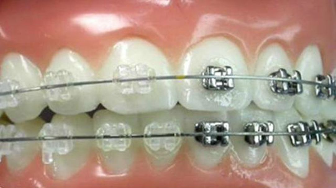 №43, Элина Коган Ортодонт, Санкт-Петербург №43, Элина Коган Ортодонт, Санкт-Петербург