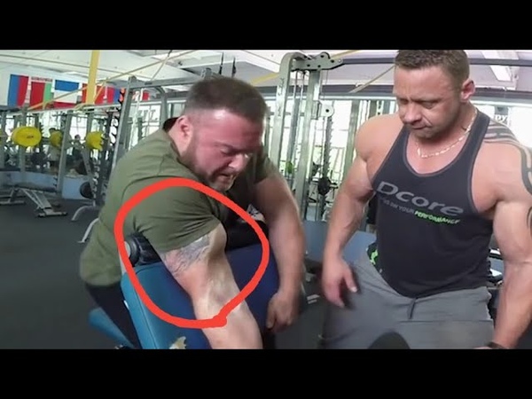 ШОК Порвал бицепс. Слабонервным не смотреть shock tore biceps