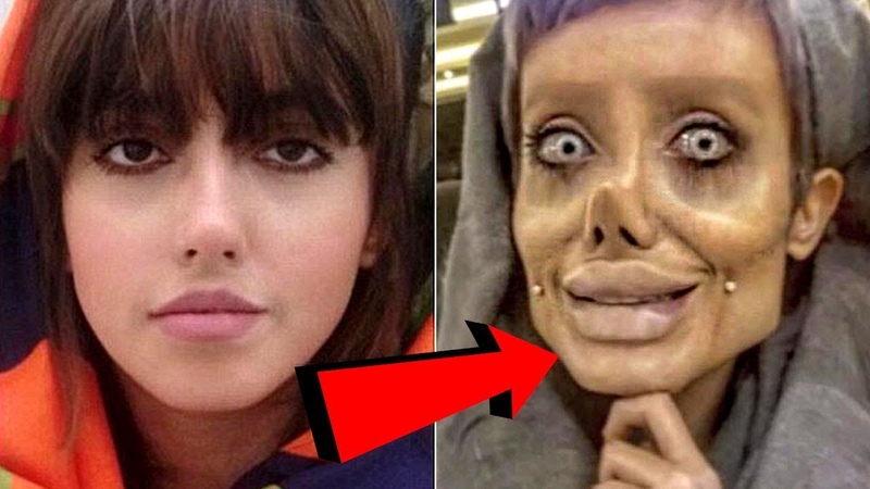 Women Gets 50 Surgeries To Look Like Angelina Jolie Sahar
