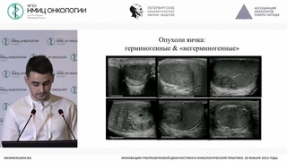 Роль мультипараметрического УЗИ в диагностике опухолей яичек