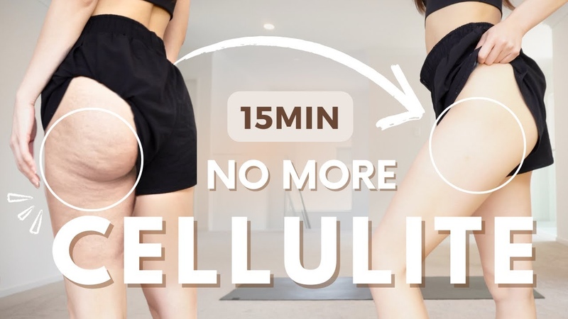 15min Cellulite workout ( Burn Thighs + Hips Fat, Tighten Skin) BEST Thigh Glute Burn (100